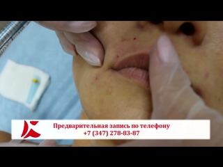 porn красивые губы важнейший элемент гармоничного лица porn