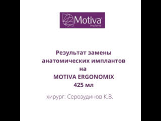 porn замена анатомических имплантов на ьщешмф укпщтщьшя porn