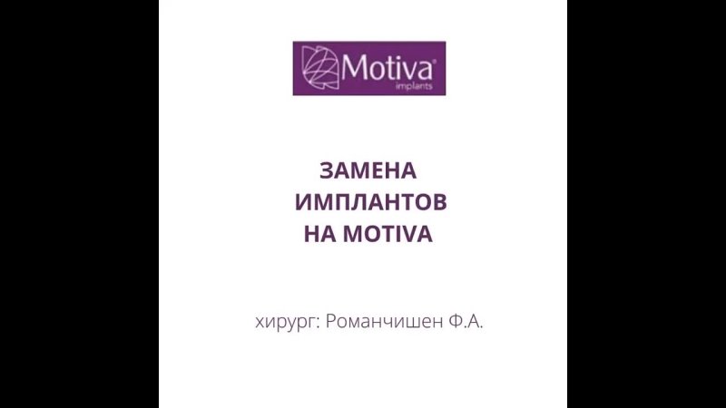 porn замена имплантов через 18 лет после устанои porn