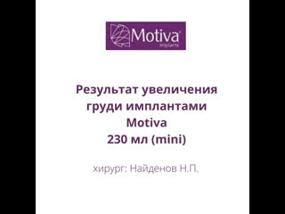 porn результат увеличения груди через 2 недели после операции porn