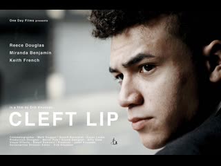 porn заячья губа cleft lip 2018 великобритания porn