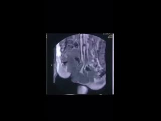 porn секс во время мрт необычный эксперимент проведенный 20 лет назад доктором тони деламотом опубликован в bmj porn