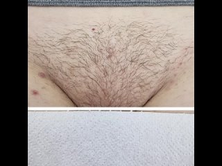 porn видео от лазернаяэлектро эпиляция стерлитамак porn