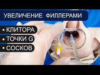 porn увеличение клитора точки g сосков филлерами контурная пластика гиалуроновая кислота porn