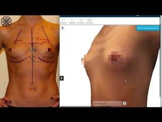 porn моделирование груди в трёхмерной проекции результат допосле porn