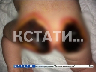 porn жуткий ожог получил грудной ребенок в нижегородской больнице а врачи вместо оказания помощи попытались все скрыть porn