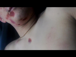 porn 18 осмотр трупа забитого насмерть парня 28 и лет служителями закона porn