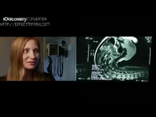 porn sls самая гибкая девушка в мире юлия гюнтель из набережных челнов porn