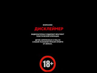 porn эндопротезирование молочных желёз в клиника нм porn