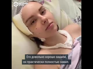 porn пострадавшая во время протестов в минске уже месяц в больнице porn