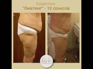 porn результат прохождения комплекса лифтинг porn