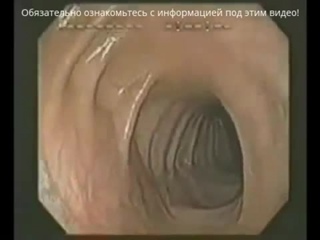 porn очищение кишечника в домашних условиях от шлаков и токсинов домашнее очищение организма препараты для очистки porn