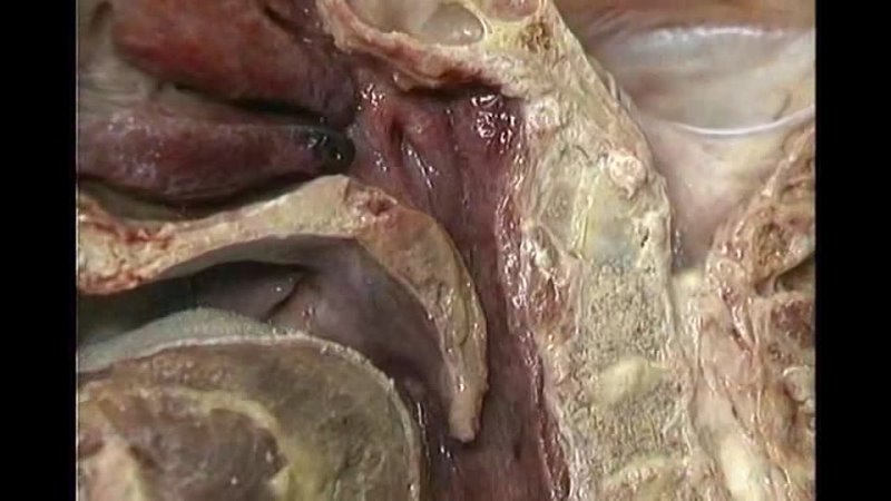 porn saree aclands dvd atlas human anatomy 4of6 head and neck part 1 mp3 wogre porn