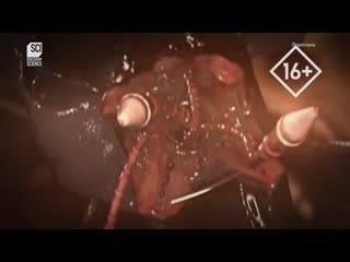 porn монстры внутри меня где у меня червь porn