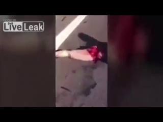 porn мотоциклист разбился на скорости в 300 км шок18 motorcycle accident with 30 porn