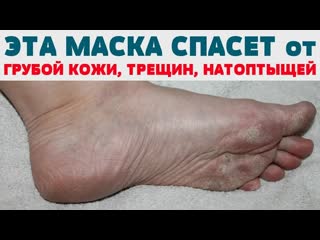 porn легкий способ сделать пятки гладкими стопы пятки без натоптышей трещин грубой кожи мазолей porn
