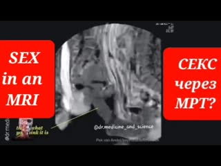 porn вам интересно как выглядит секс через аппарат мрт porn