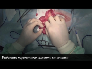 porn резекция и анастомоз кишечника у кота intestinal resection in cat porn