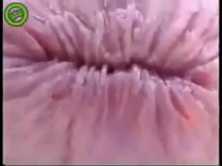 porn плавающая анальная трещина мышца сфинктера porn